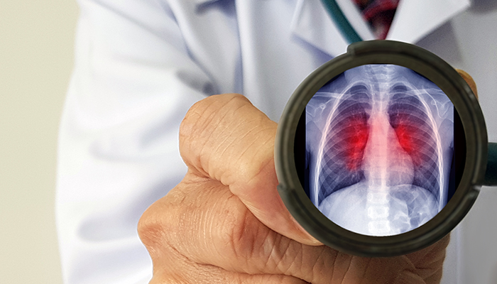 a doctor holding up a stethiscopre with a graphic of an xray inside